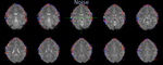 How clean fMRI data with FIX-ICA