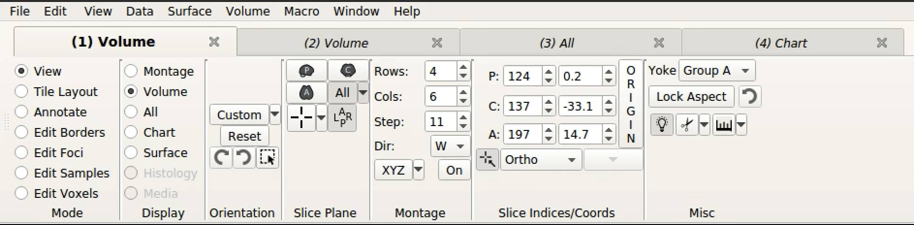 Volume Setting