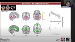 The role of M1 GABA in retention